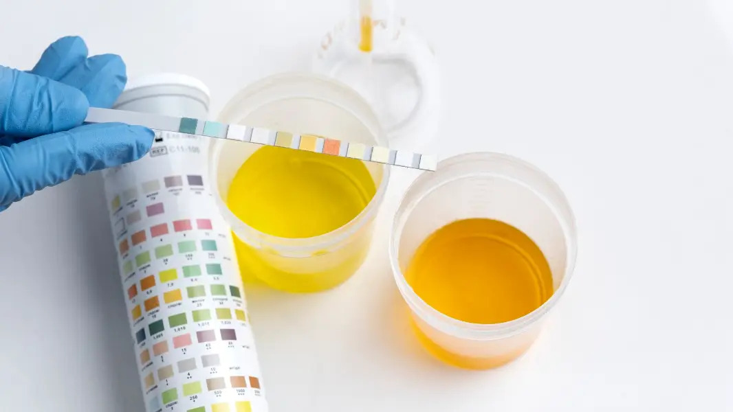 Lab doctor performing medical exam of urine